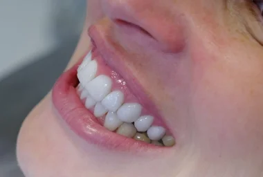 Alanya'da Diş Tedavisi Moon D.C. Dental Clinic'te 5 Avantaj
