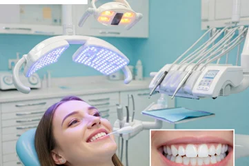 Teeth Whitening Treatment in Alanya: Methods and Effects - Moon Dental Alanya Blog