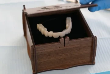 Alanya Diş Klinikleri: Çoklu İmplant Uygulamaları ve İyileşme Süreçleri - Moon Dental Alanya Blog