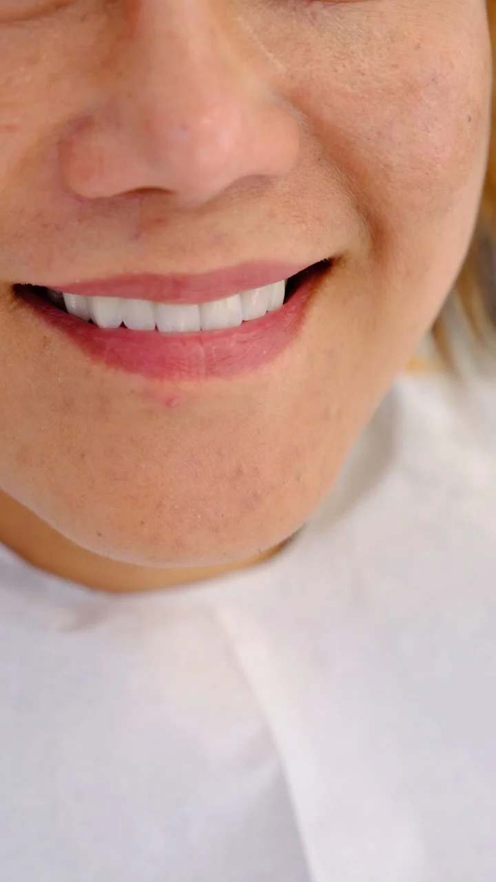Dental Selfie: Gülüşünüzün Fotoğraflarda Daha Beyaz Görünmesini Sağlayın